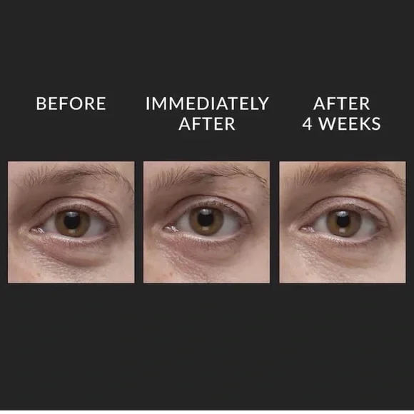 Kate Somerville DermalQuench Liquid LiftAdvanced Wrinkle Treatment Anti Aging